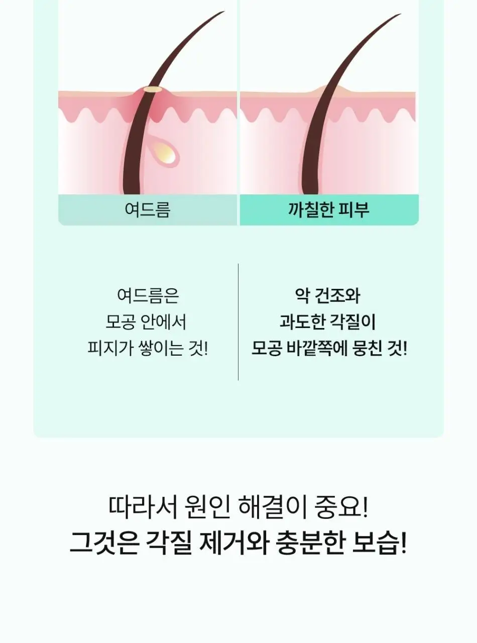 [피부결/각질케어] 낫포유 닭살/모공각화 매끈 바디 미스트 115ml 상세페이지 8